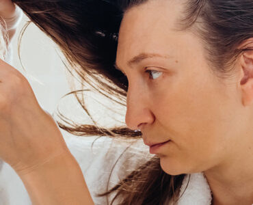 Hair Shedding vs Hair Loss