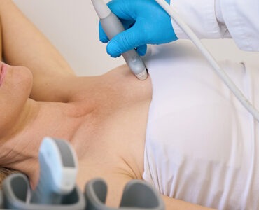 A woman with dense breasts being screened for breast cancer with an ultrasound.