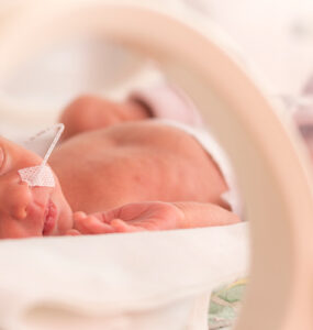 A newborn baby in the NICU, being treated for CDH.