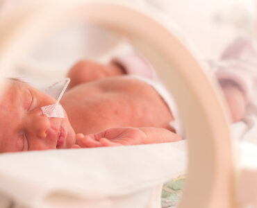 A newborn baby in the NICU, being treated for CDH.
