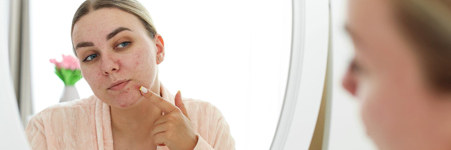 women looking in the mirror at her chin