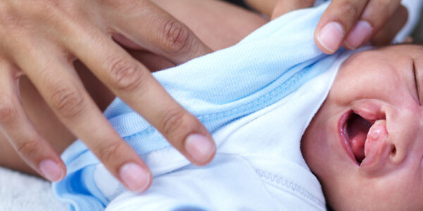 Cleft Lip and Palate: What Parents Need to Know