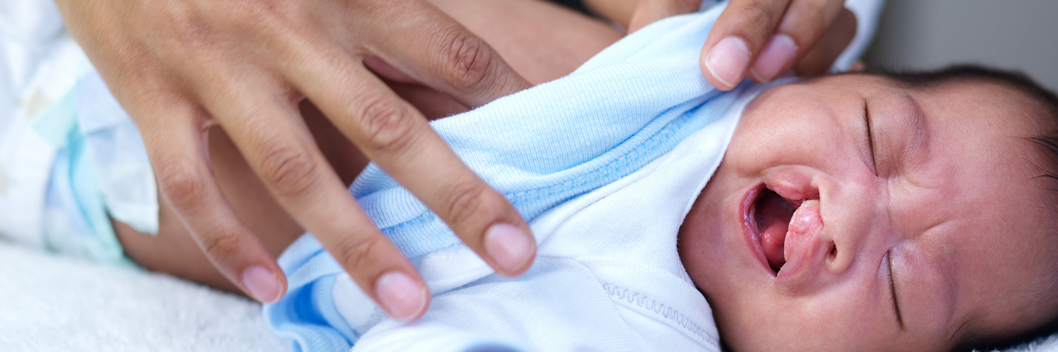 Newborn with cleft palate.