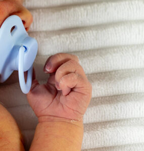 White newborn baby with jaundice.