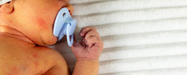 White newborn baby with jaundice.