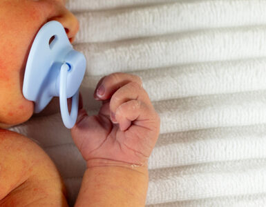 White newborn baby with jaundice.