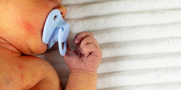 When Does Newborn Jaundice Require the NICU? Signs, Treatment and Recovery