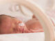 Premature newborn baby girl in the hospital incubator.